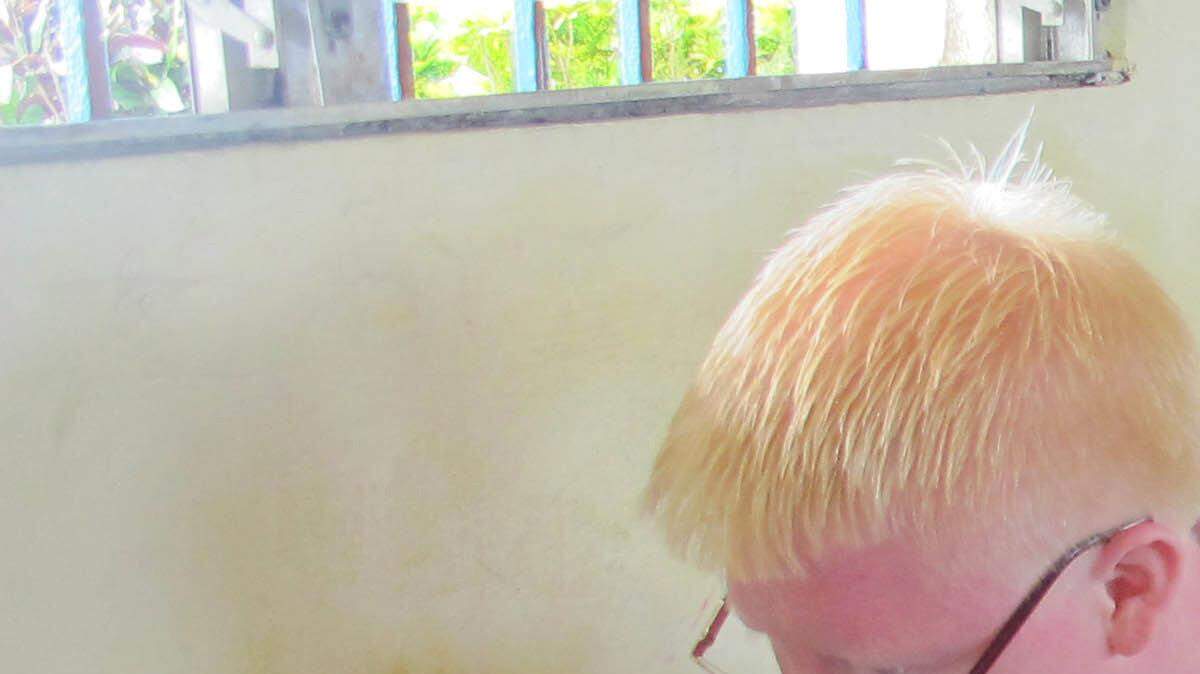WORLD NEWS PANAMA-ALBINOS 2 MCT
