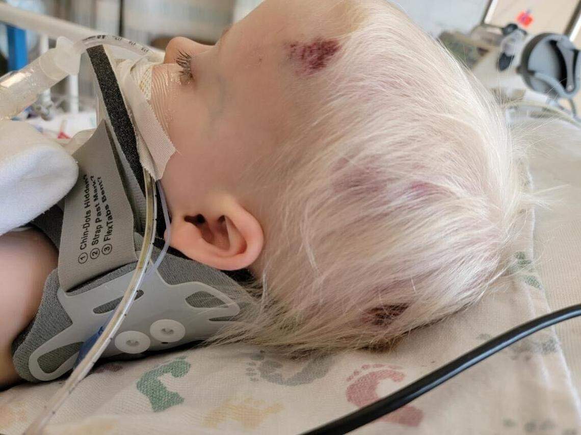 Jeffrey Thor, 2, was thrown about 25 feet from his stroller when he was struck by a driver on May 23 in Spokane Valley, Washinton, his father said. He was taken to a hospital in critical condition.