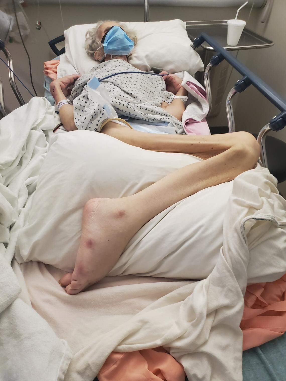 An image of Sarita Redmond in the final days of her life, a month after she had tested positive for COVID-19.