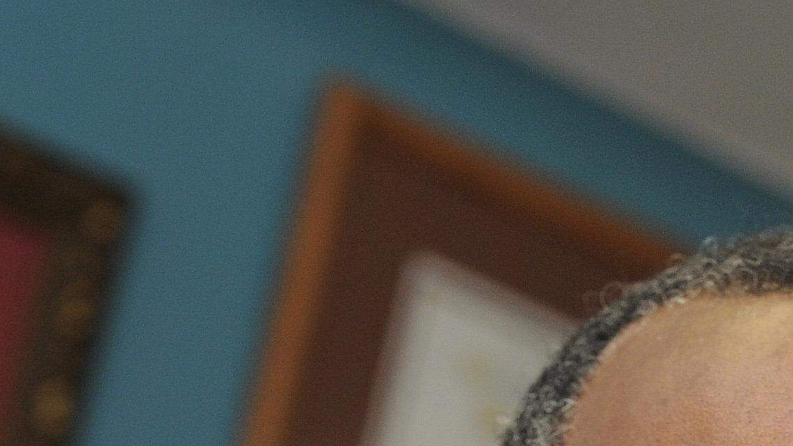 US NEWS MED-CARSON BZ