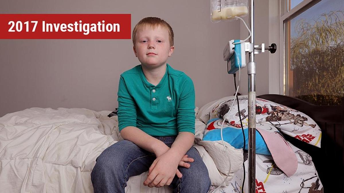 Jackson Bell uses a feeding tube due to multiple eosinophilic disorders.