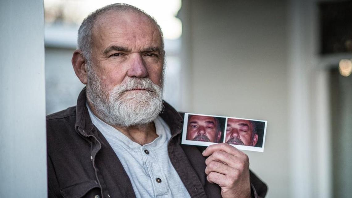 John Swain, who worked as an operator at the Hanford Site nuclear complex, was in an accident on August 17, 2003, that left him with toxic encephalopathy, reactive airways disease syndrome and neuropathy of the lower extremities. His left eye swells up from time to time when he is exposed to certain common chemicals. He is photographed in his home in Richland, Wash., on Dec. 30, 2015.