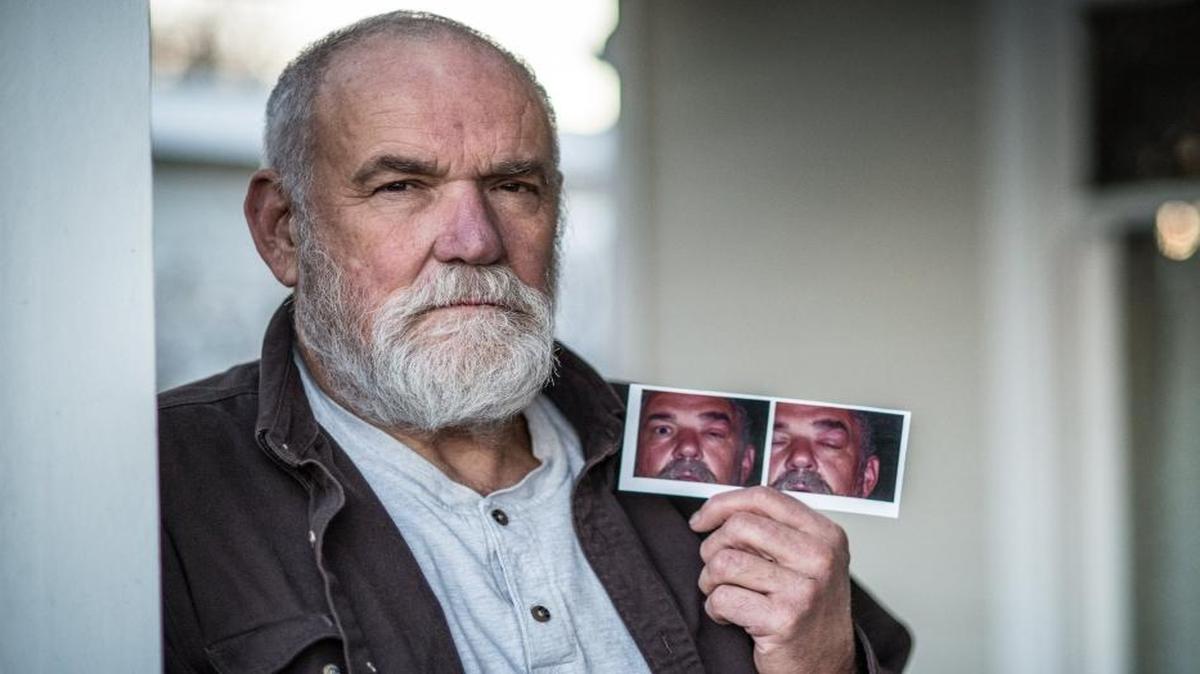 John Swain, who worked as an operator at the Hanford Site nuclear complex, was in an accident on August 17, 2003, that left him with toxic encephalopathy, reactive airways disease syndrome and neuropathy of the lower extremities. His left eye swells up from time to time when he is exposed to certain common chemicals. He is photographed in his home in Richland, Wash., on Dec. 30, 2015.