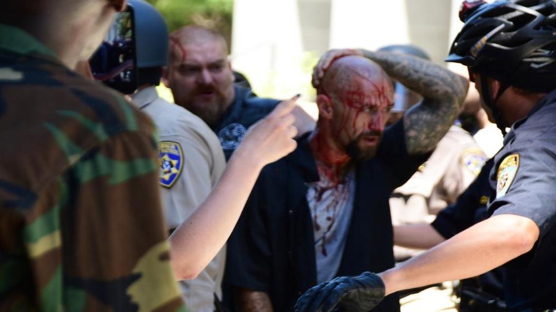 Police escort a wounded man from the Sacramento protests Sunday after members of right-wing extremist groups holding a rally outside the California Capitol clashed with counter-protesters, authorities said. The Traditionalist Workers Party had scheduled and received a permit to protest at noon Sunday.