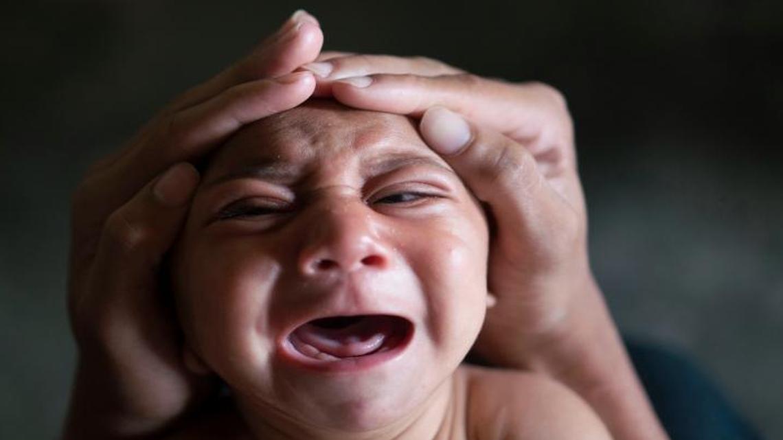 Microcephaly is a possible complication of Zika virus infections in pregnant women. But French researchers identified Gullian-Barre Syndrome, which causes paralysis, as another one two years ago.