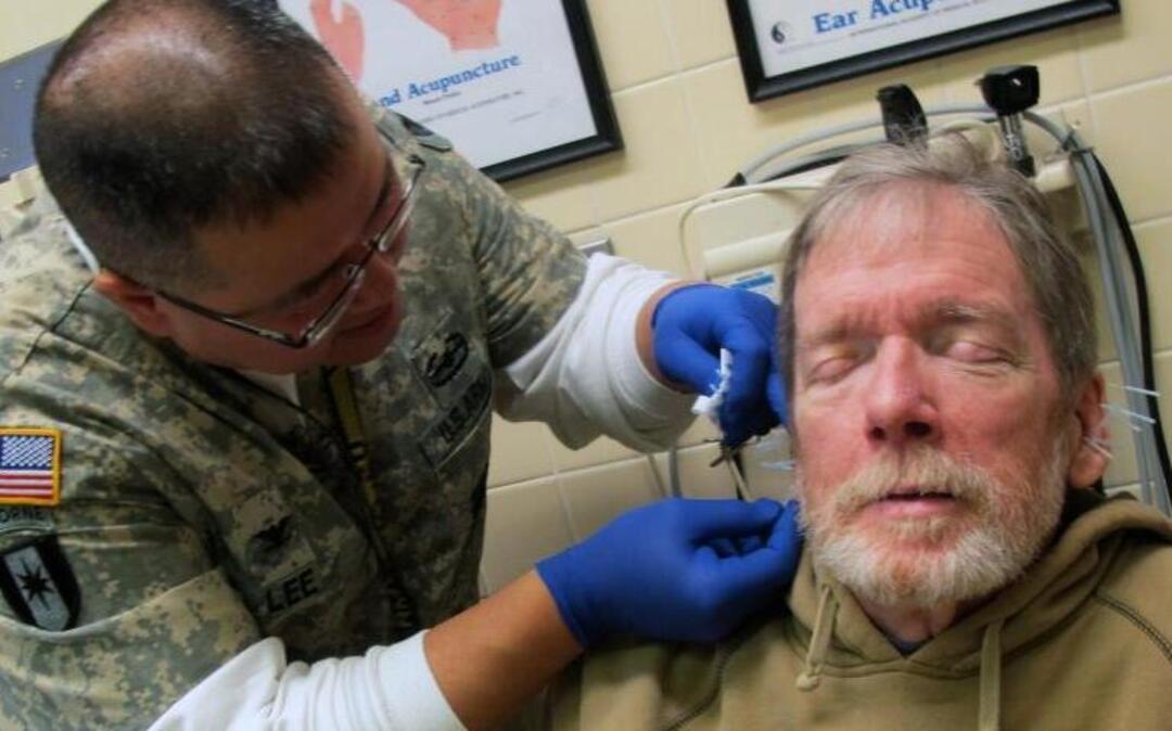 A doctor performs acupuncture on a paralyzed patient at the Milwaukee VA Medical Center. Veterans eligible for VA treatment would lose federal tax credits under a House-passed repeal of Obamacare – even if they choose not to accept VA care.